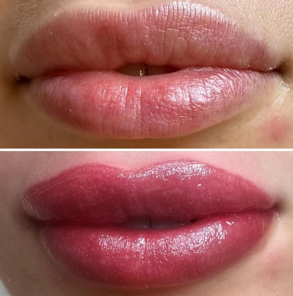 שפתיים הודיה אברהם 1